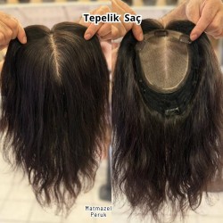 Ankara Kızılayda Tül Tepelik Hava Alır İpek Taban Tepelik Alt Yapılı